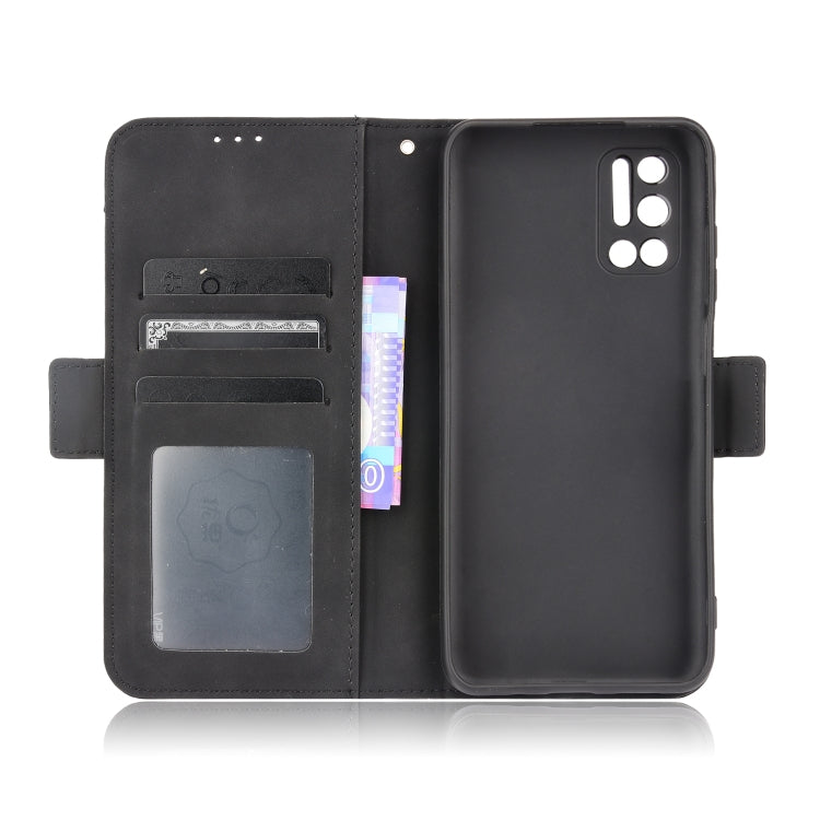 For Doogee N40 Pro Skin Feel Calf Pattern Horizontal Flip Leather Case with Holder & Card Slots & Photo Frame(Black)