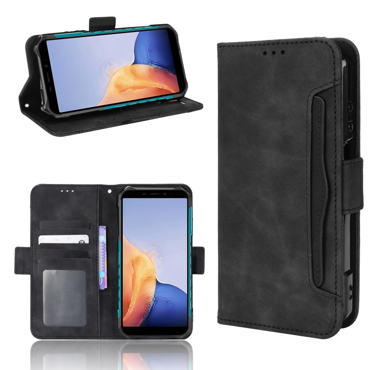 For Ulefone Armor X9 Skin Feel Calf Pattern Leather Phone Case(Black)