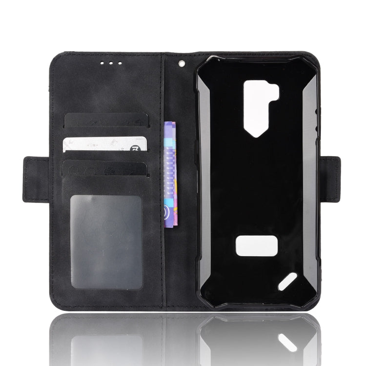 For Ulefone Armor X9 Skin Feel Calf Pattern Leather Phone Case(Black)