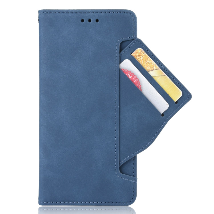 For Ulefone Armor X9 Skin Feel Calf Pattern Leather Phone Case(Blue)