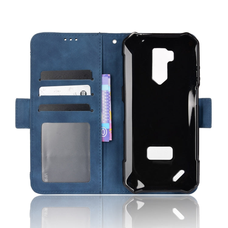 For Ulefone Armor X9 Skin Feel Calf Pattern Leather Phone Case(Blue)