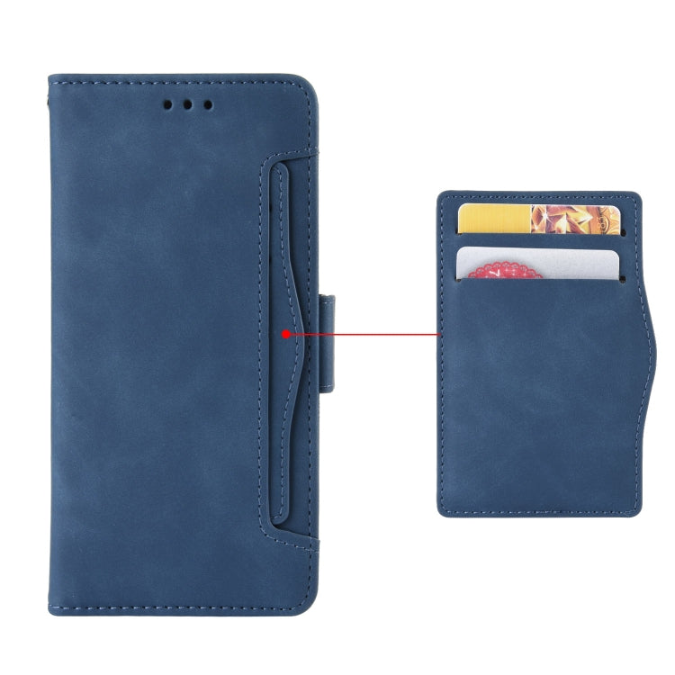For Ulefone Armor X9 Skin Feel Calf Pattern Leather Phone Case(Blue)