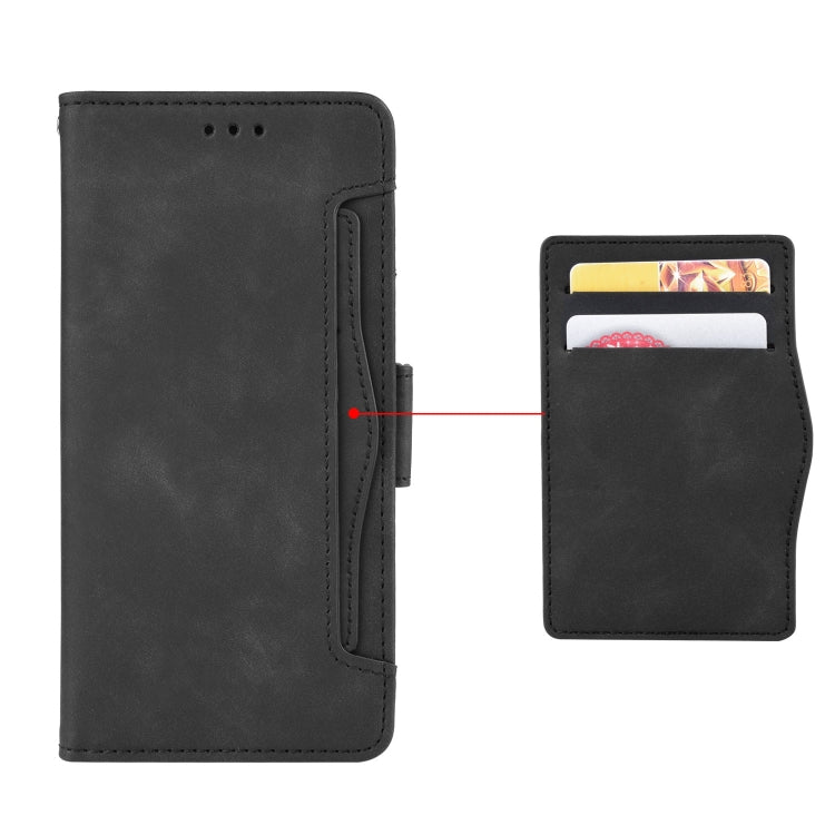 For Ulefone Note 6 / Note 6P Skin Feel Calf Pattern Leather Phone Case(Black)