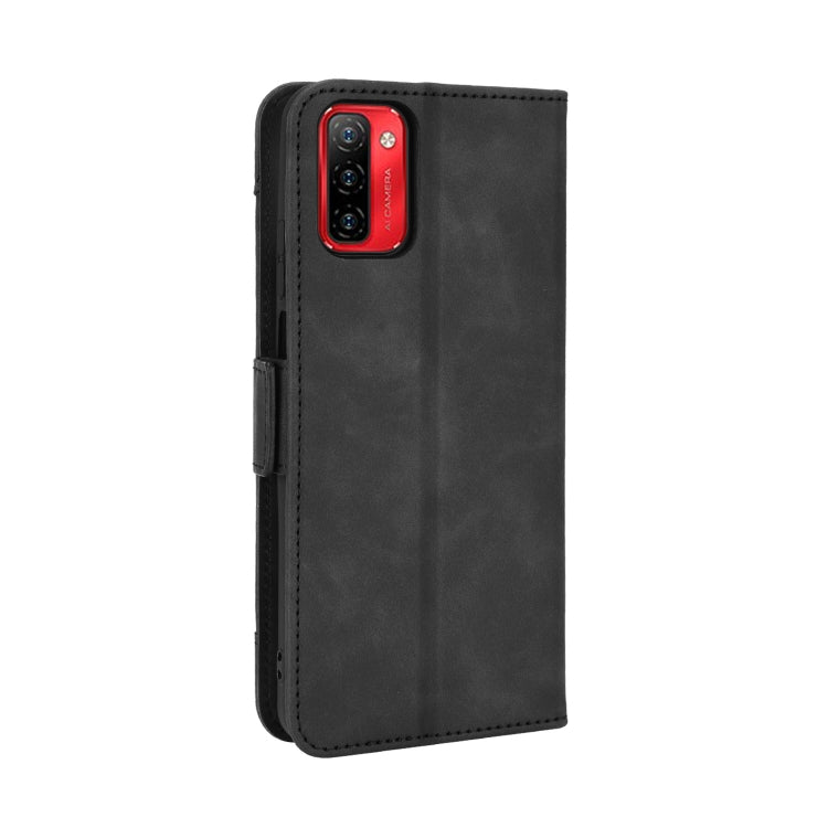 For Ulefone Note 12P Skin Feel Calf Pattern Leather Phone Case(Black)