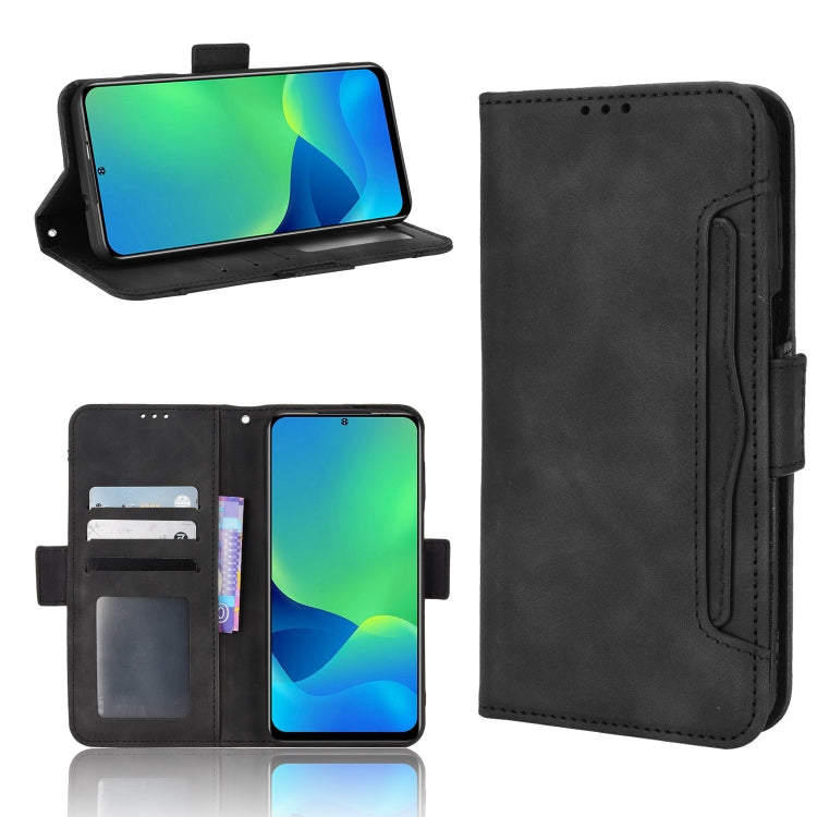 For Ulefone Note 13P Skin Feel Calf Pattern Leather Phone Case(Black)