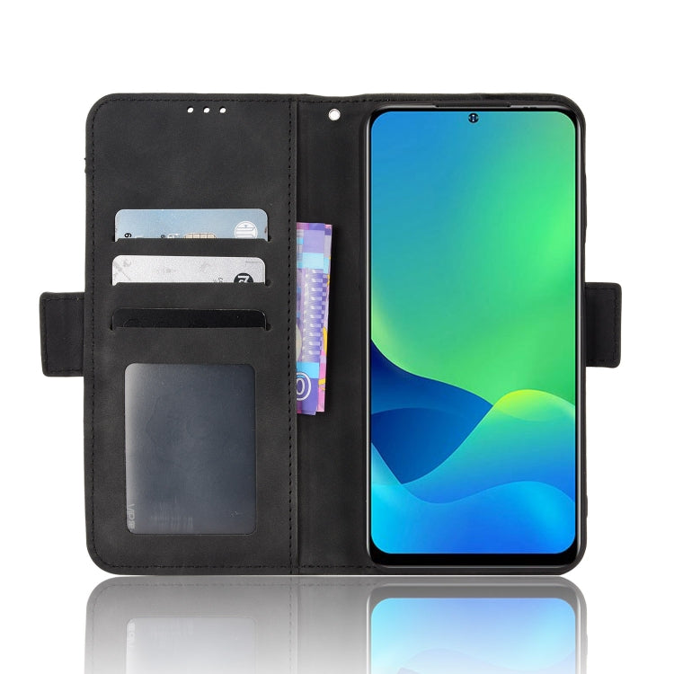 For Ulefone Note 13P Skin Feel Calf Pattern Leather Phone Case(Black)