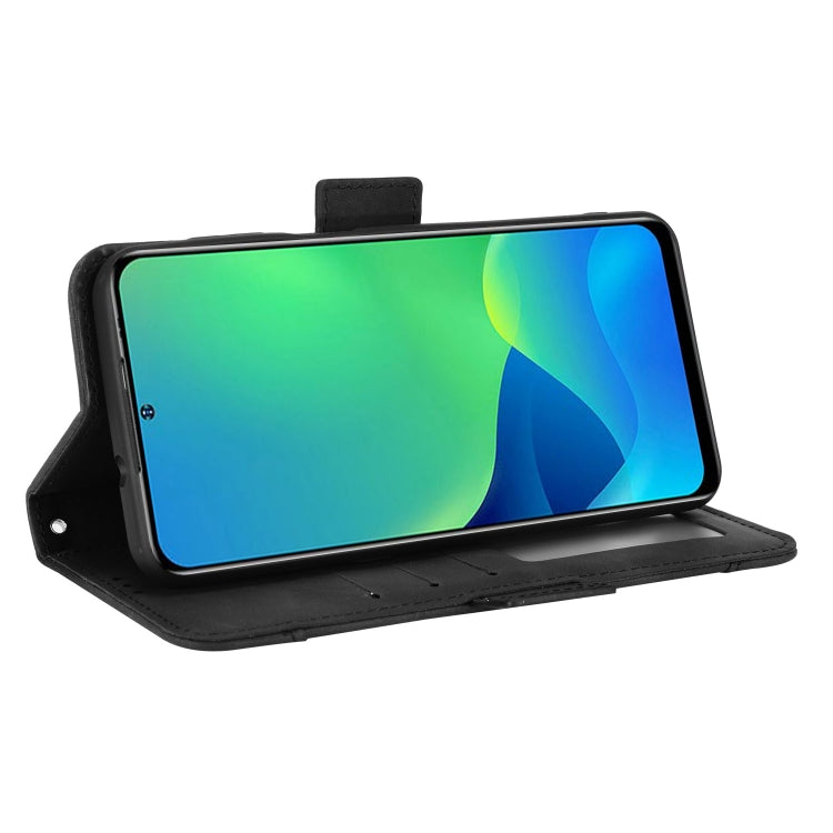 For Ulefone Note 13P Skin Feel Calf Pattern Leather Phone Case(Black)