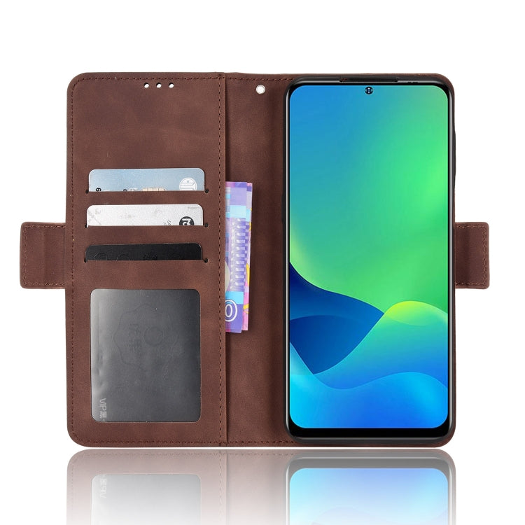 For Ulefone Note 13P Skin Feel Calf Pattern Leather Phone Case(Brown)
