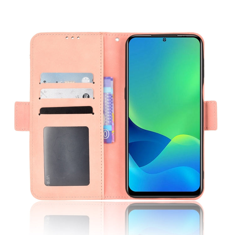 For Ulefone Note 13P Skin Feel Calf Pattern Leather Phone Case(Pink)