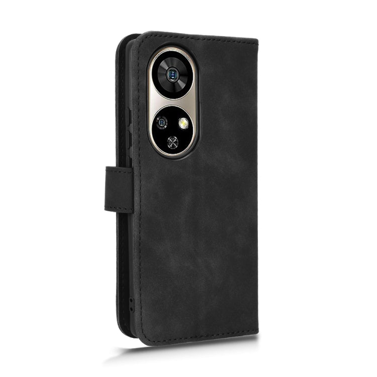 For Ulefone Note 17 Pro Skin Feel Magnetic Flip Leather Phone Case(Black)