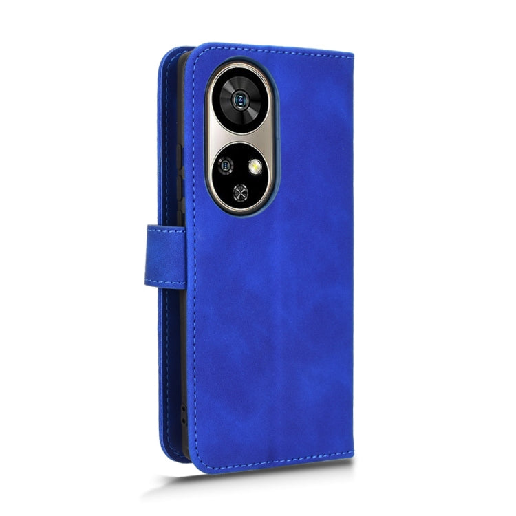 For Ulefone Note 17 Pro Skin Feel Magnetic Flip Leather Phone Case(Blue)