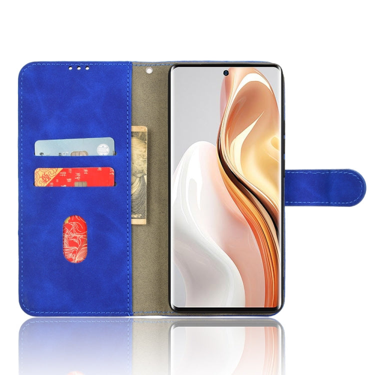 For Ulefone Note 17 Pro Skin Feel Magnetic Flip Leather Phone Case(Blue)