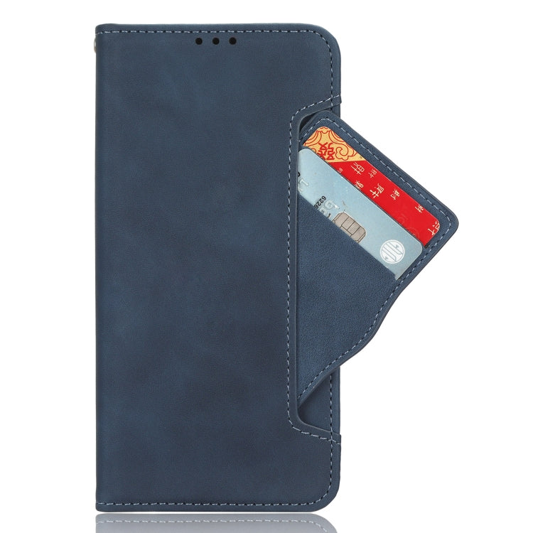 For Ulefone Note 15 Skin Feel Calf Texture Card Slots Leather Phone Case(Blue)