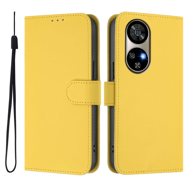For Ulefone Note 17 Pro Skin Feel Solid Color Leather Phone Case with Lanyard(Lemon Yellow)