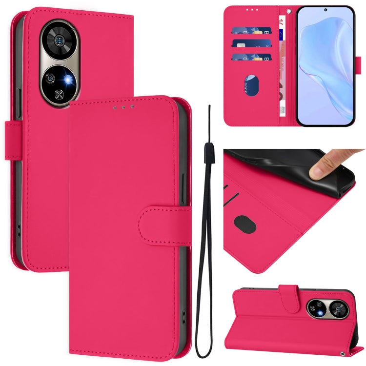 For Ulefone Note 17 Pro Skin Feel Solid Color Leather Phone Case with Lanyard(Rose Red)