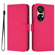 For Ulefone Note 17 Pro Skin Feel Solid Color Leather Phone Case with Lanyard(Rose Red)
