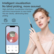NK-5101 HD Smart Visual Ear Spoon(Black + White)