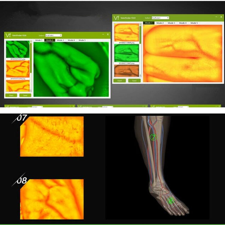P2-1 Vascular Vein Display Inspection Camera