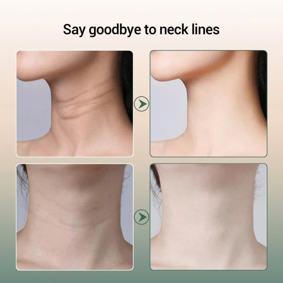 HY38 EMS Micro-Current Constant Temperature Neck Beauty Instrument Facial Introduction Device(Black)