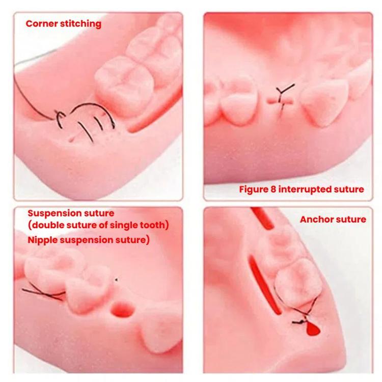 Gums Multiple Wounds Silicone Suture Practice Mold Four Teeth Oral Surgery Training Module For Medical Students