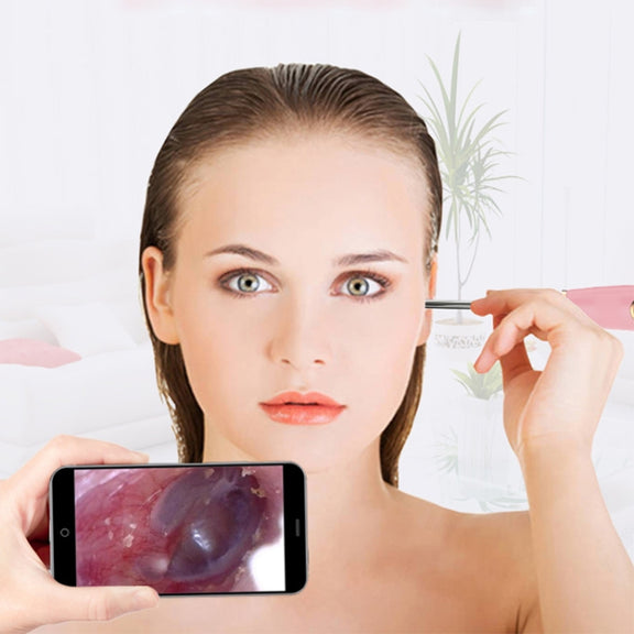 A2 WiFi Endoscope Camera 720P Ear Cleaning Wireless Safe Ear Pick Tool Visual Ear Spoon, Diameter: 4.4mm(Pink)