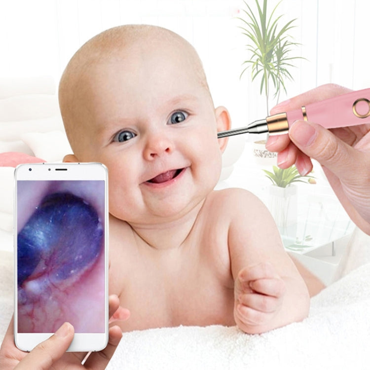 A1 WiFi Endoscope Camera 720P Ear Cleaning Wireless Safe Ear Pick Tool Visual Ear Spoon, Diameter: 3.9mm(White)