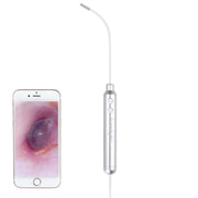 Supereyes Y001 Ear Mite Mouth Electronic Digital Fixed Focus Endoscope
