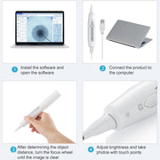 Supereyes Y008 Ear Nose Mouth Wireless Digital Electronic Endoscope