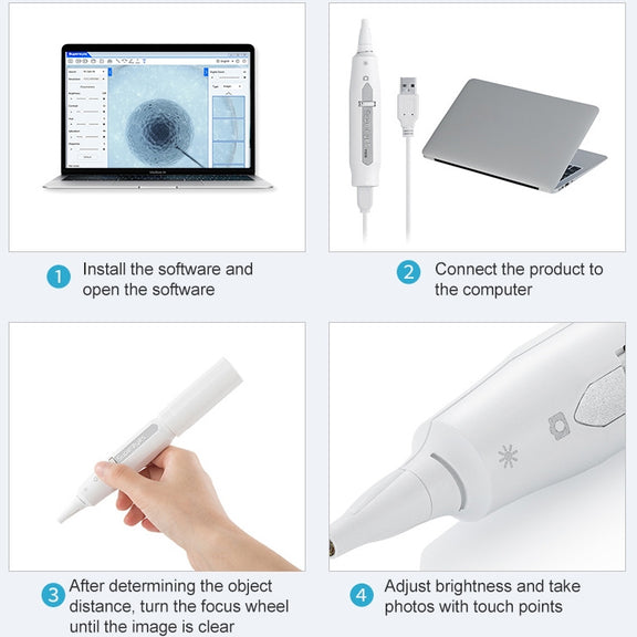 Supereyes Y008 Ear Nose Mouth Wireless Digital Electronic Endoscope