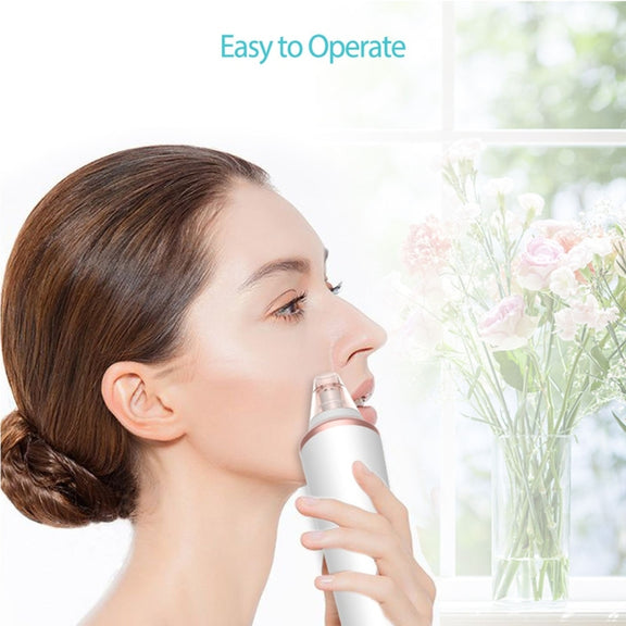 XPREEN XPRE037 Wireless Charging  Multi-function Blackhead Extractor Pore Cleanser with Four Probes & LED Lighting Function(White)